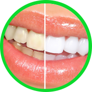 Blanqueamiento dental